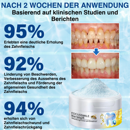 ❤️🔥Furzero™ Focussmile Bienengift Behandlung Pulver zum Einnehmen 🦷 (🇩🇪 BZÄK Recommended)