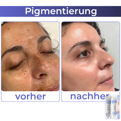 🌍flysmus™ Fortgeschrittene Kollagen Vollständig Augencreme