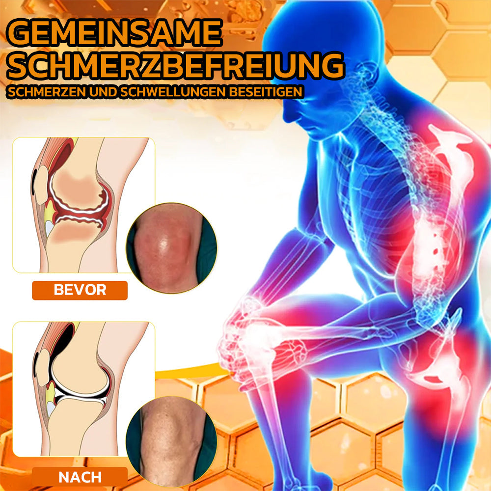 🥇Aetheris™ Bienengift Sofort-Ultra-Stärke Schmerztherapie-Creme🇩🇪DGOU Genehmigt🇩🇪