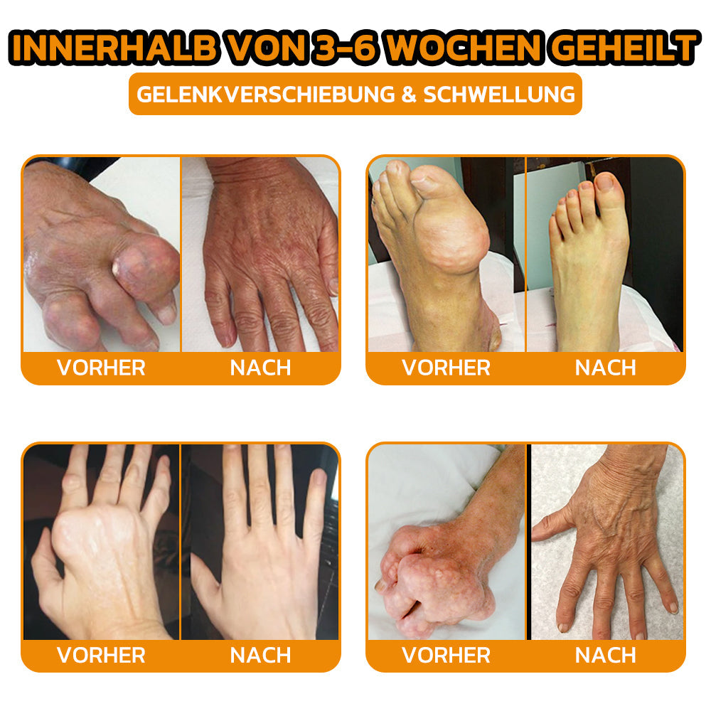 🧡Aetheris™ Bienengift Sofort-Ultra-Stärke Schmerztherapie-Creme🇩🇪DGOU Genehmigt