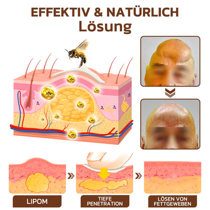 GFOUK™ Maryanni Bienengift Lymphatische Erholungscreme