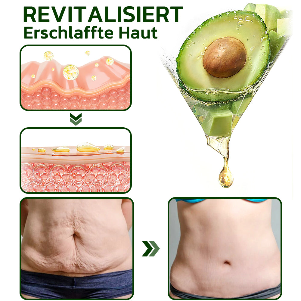 flysmus™ Avocado Straffendes & Falten reduzierendes Körperlotion-Peeling (🇩🇪 DDG Recommended)