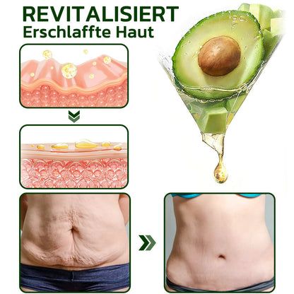 flysmus™ Avocado Straffendes & Falten reduzierendes Körperlotion-Peeling (🇩🇪 DDG Recommended)