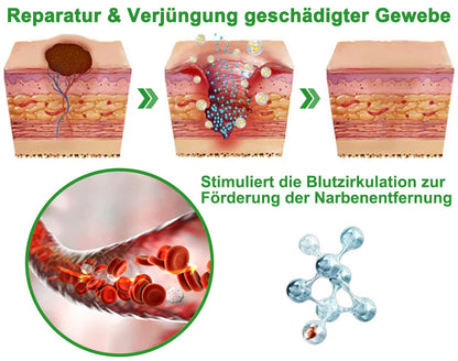 🇩🇪✅Offizieller Shop: flysmus™ Lidocain 5-Minuten Schmerzlinderung Heilspray👨‍⚕️DGOU Genehmigt✅Reduzierung von Gelenkschwellungen, Schmerzen, Steifheit, Rötungen, Wärme, Empfindlichkeit und Gelenkermüdung