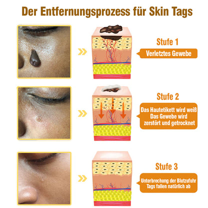 flysmus™ Creme zur Entfernung von Bienengift-Tags 🌿 Hergestellt in Deutschland 🇩🇪 DDG Recommend