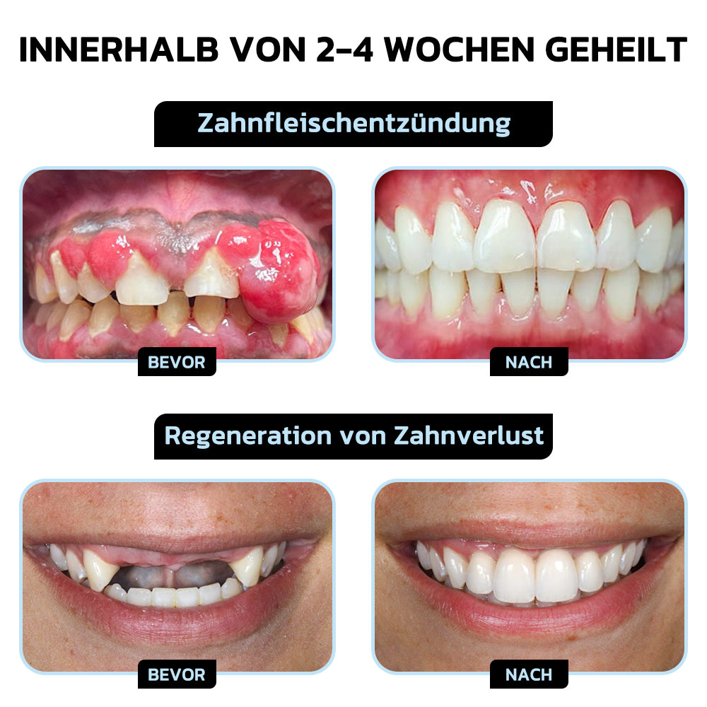 🦷🎖️Furzero™ Focussmile Bienengiftbehandlung Pulver zum Einnehmen (🇩🇪 BZÄK Zugelassen)