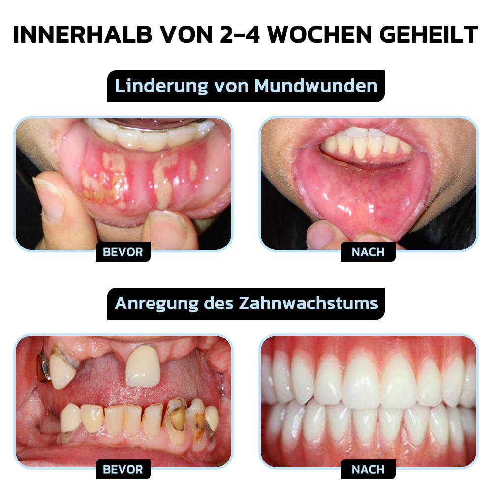 🎖️Furzero™ Focussmile Bienengiftbehandlung Pulver zum Einnehmen (🇩🇪 BZÄK Zugelassen)