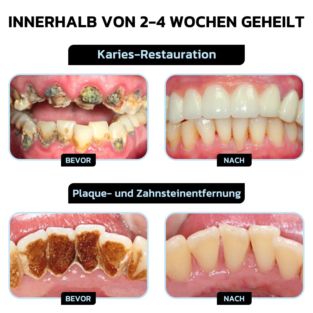 🦷 Furzero™ Focussmile Bienengiftbehandlung Pulver zum Einnehmen (🇩🇪 BZÄK Zugelassen)