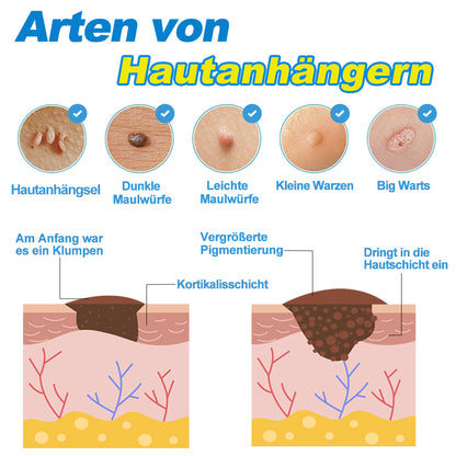 GFOUK™ Schnelles pflanzliches Tag-Entfernungsset