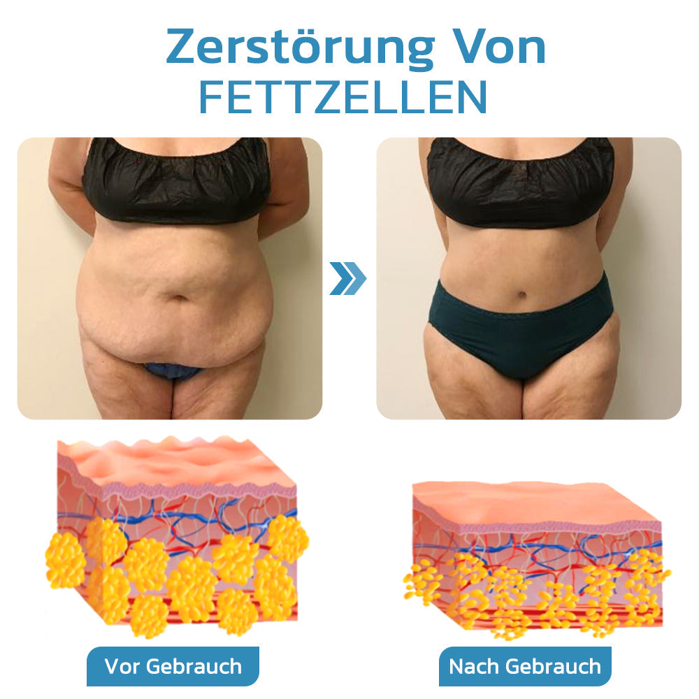 Furzero™ Slendery Ultraschall Lymphmassagegeräts