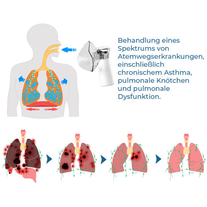 GFOUK™ LungDetox Vernebler-Reinigungsspray